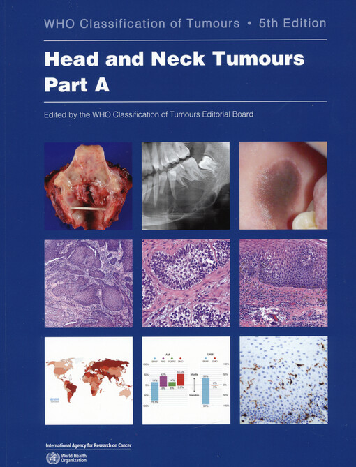 Head and neck tumours. Part B