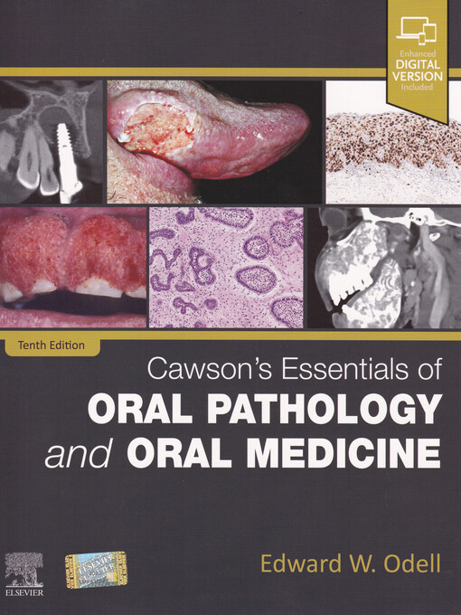 Cawson's Essentials of Oral Pathology and Oral Medicine