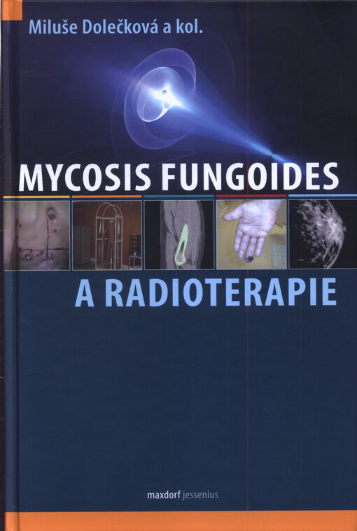 Mycosis fungoides a radioterapie