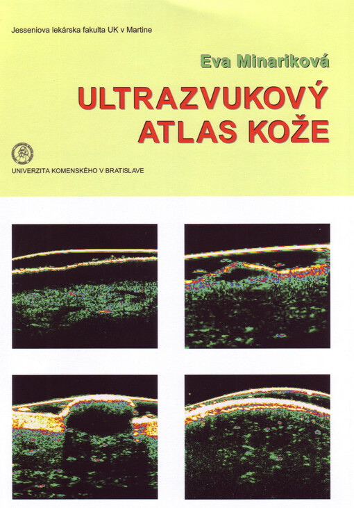 Ultrazvukový atlas kože