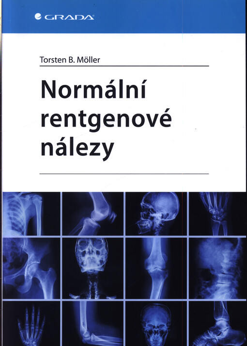 Normální rentgenové nálezy