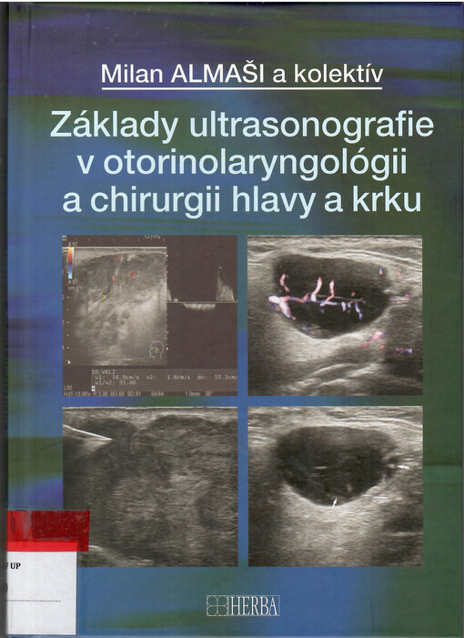 Základy ultrasonografie v otorinolaryngológii a chirurgii hlavy a krku