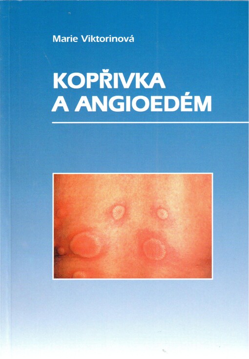Kopřivka a angioedém