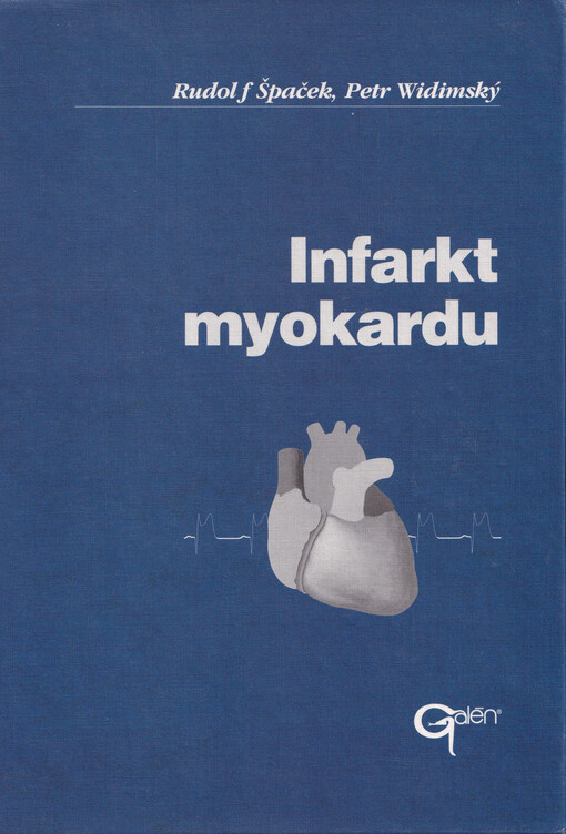 Infarkt myokardu