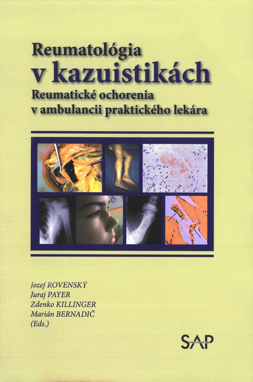 Reumatológia v kazuistikách