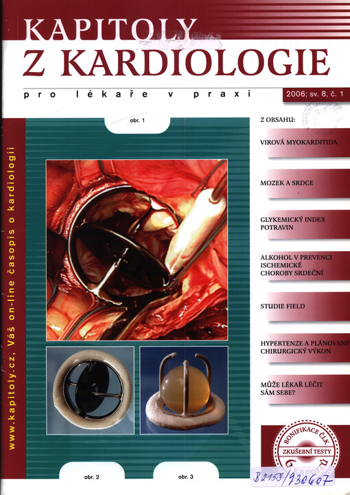 Kapitoly z kardiologie pro lékaře v praxi