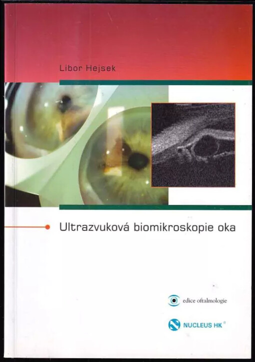 Ultrazvuková biomikroskopie oka