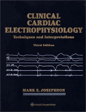 Clinical Cardiac Electrophysiology: Techniques and Interpretations