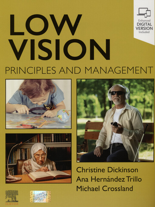 Low vision : principles and management