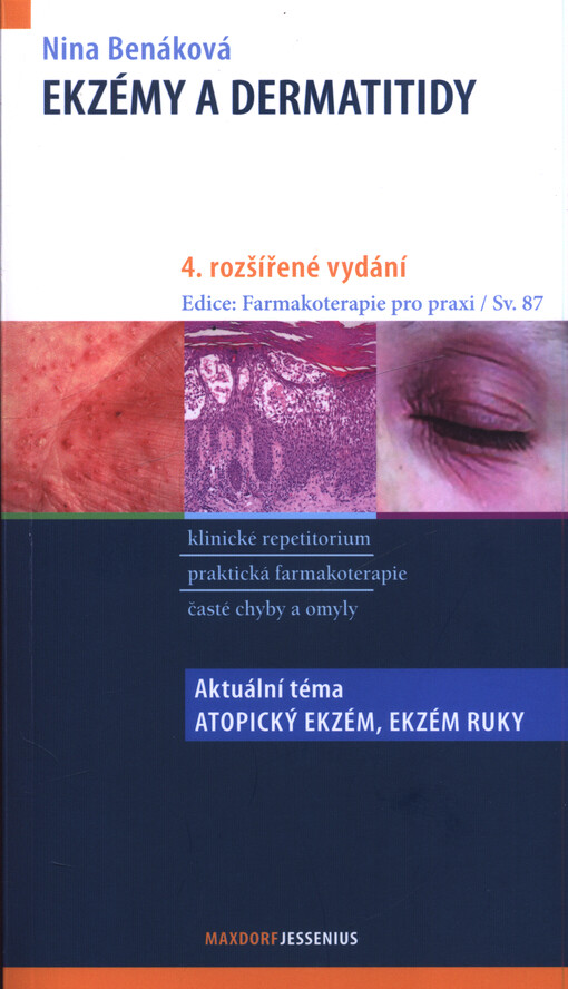 Ekzémy a dermatitidy