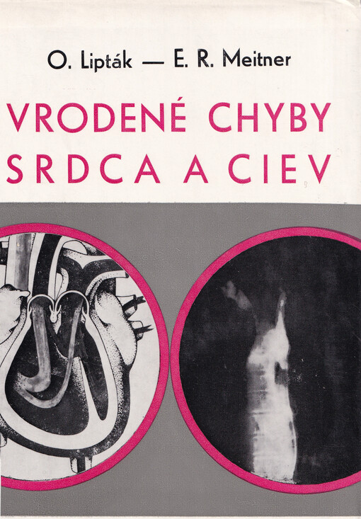 Vrodené chyby srdca a ciev