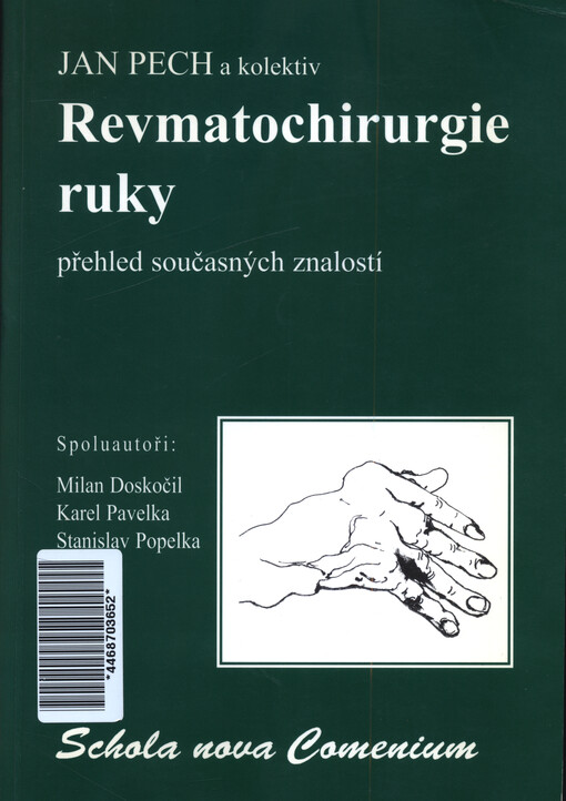 Revmatochirurgie ruky : přehled současných znalostí