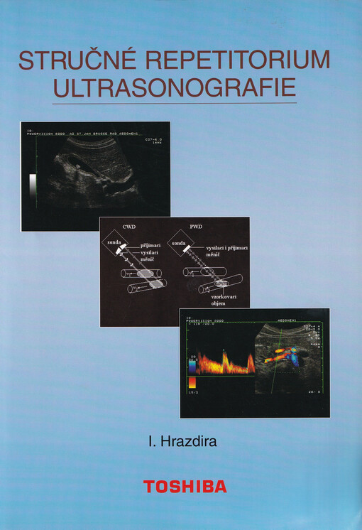 Stručné repetitorium ultrasonografie