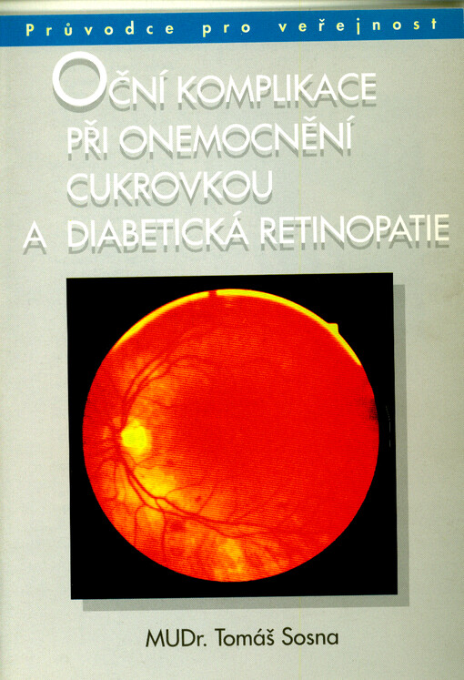 Oční komplikace při onemocnění cukrovkou a diabetická retinopatie