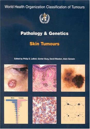 Pathology and genetics of skin tumours