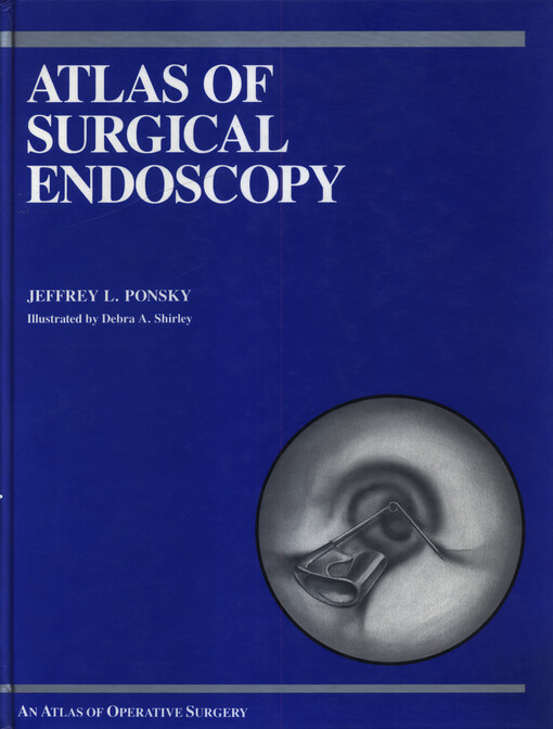 Atlas of surgical endoscopy : an atlas of operative surgery