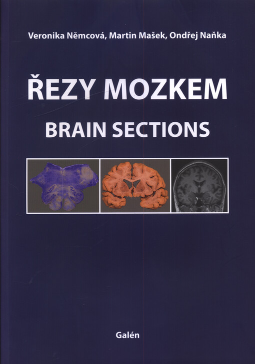 Řezy mozkem : Brain sections
