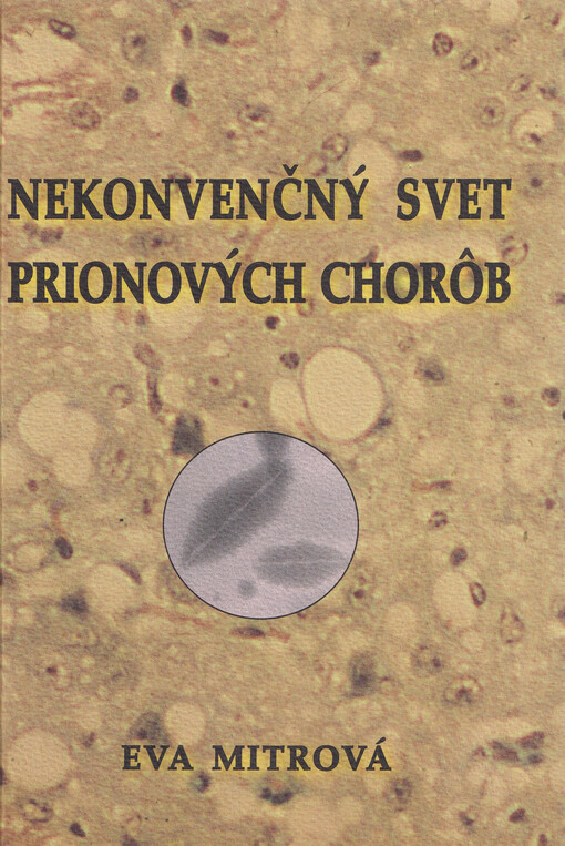 Nekonvenčný svet prionových chorôb