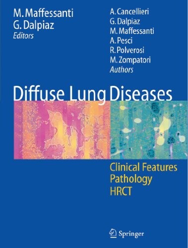 Diffuse Lung Diseases: Clinical Features, Pathology, HRCT