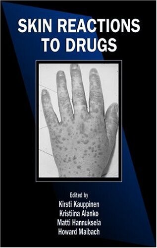 Skin reactions to drugs