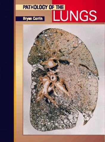 Pathology of the lungs