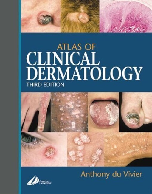 Atlas of clinical dermatology