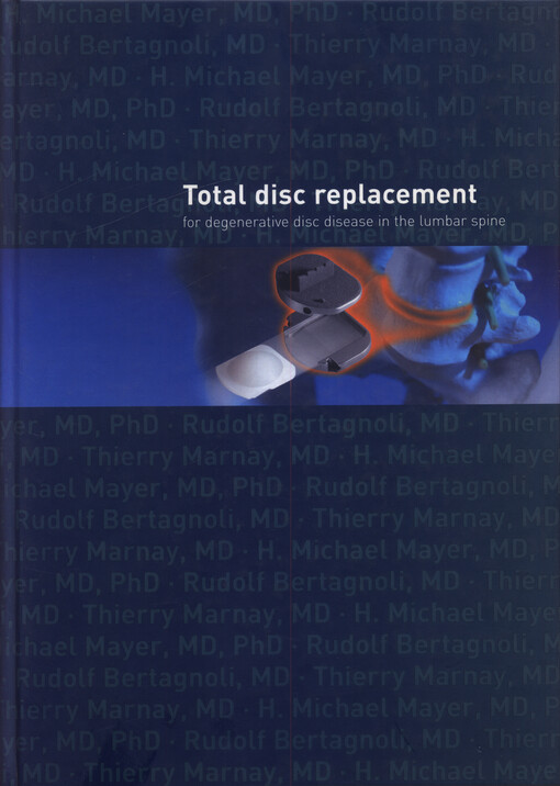 Total disc replacement