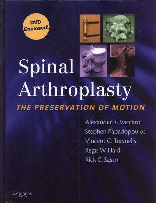 Spinal Arthroplasty