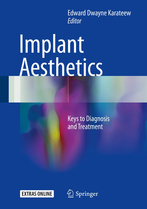 Implant aesthetics :keys to diagnosis and treatment