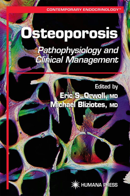 Osteoporosis :pathophysiology and clinical management