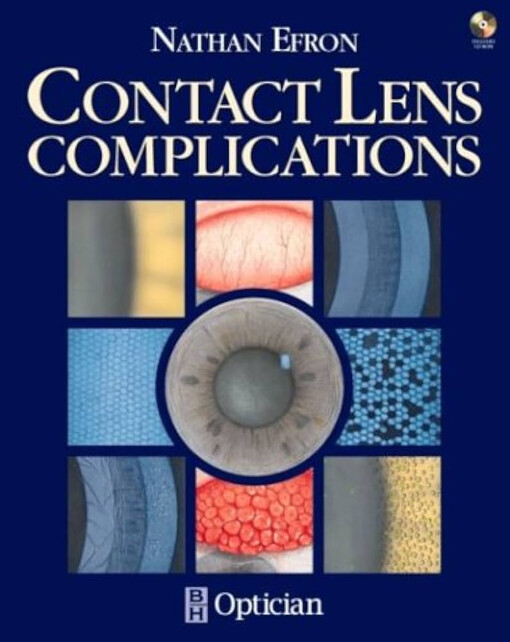 Contact lens complications