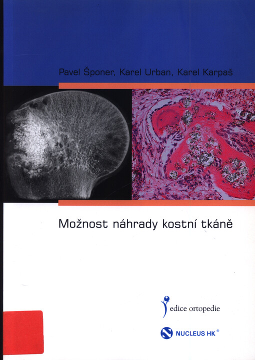 Možnost náhrady kostní tkáně