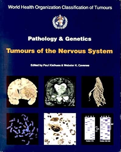 Pathology and genetics of tumours of the nervous system