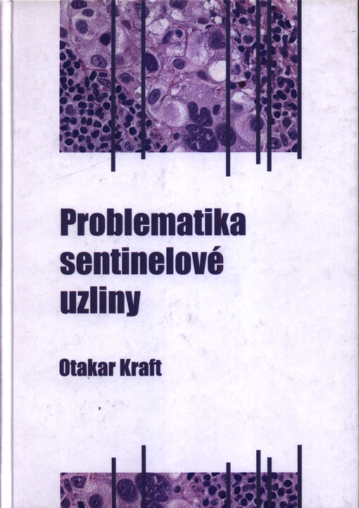 Problematika sentinelové uzliny