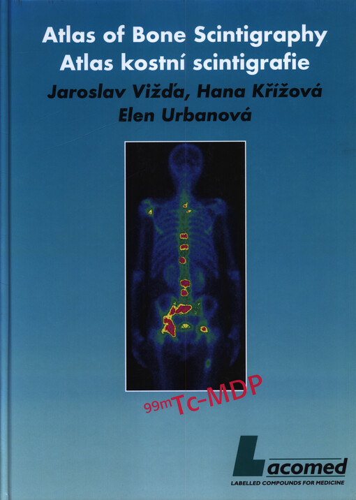 Atlas kostní scintigrafie = Atlas of bone scintigraphy