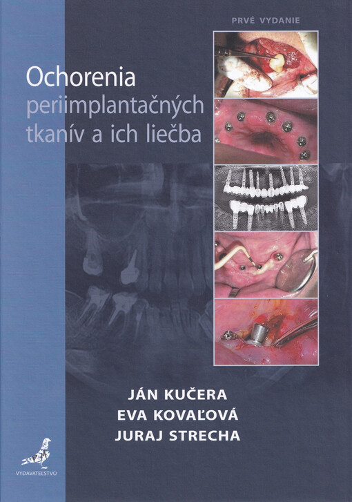 Ochorenia periimplantačných tkanív a ich liečba