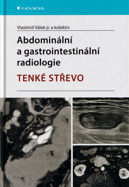 Abdominální a gastrointestinální radiologie : tenké střevo