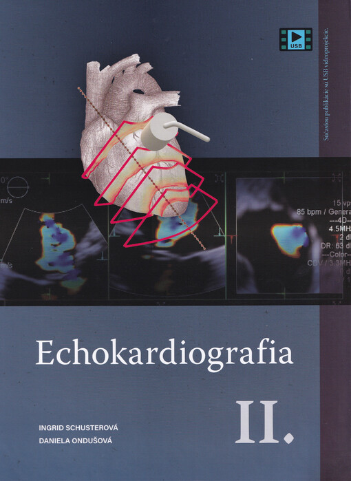 Echokardiografia II.