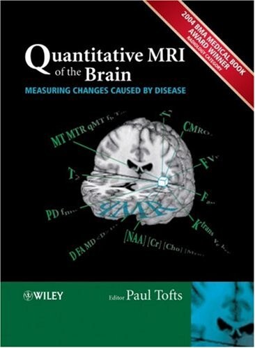 Quantitative MRI of the brain :measuring changes caused by disease
