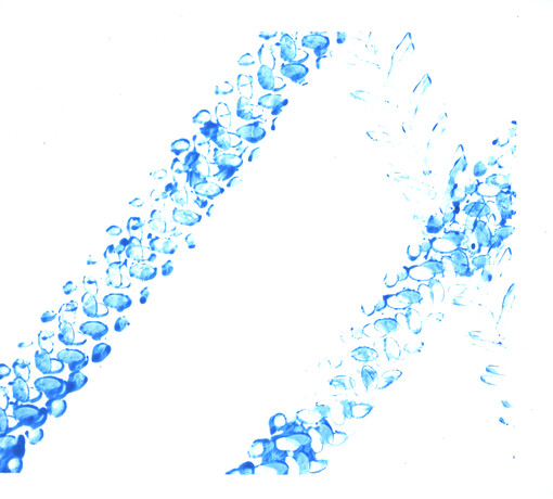 Psychopathic Romantics