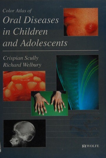 Color atlas of oral diseases in children and adolescents