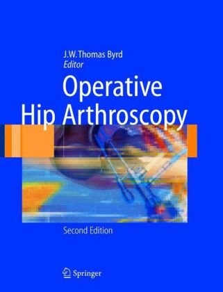 Operative Hip Arthroscopy