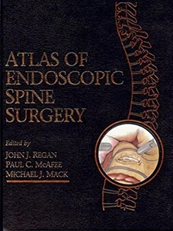 Atlas of Endoscopic Spine Surgery