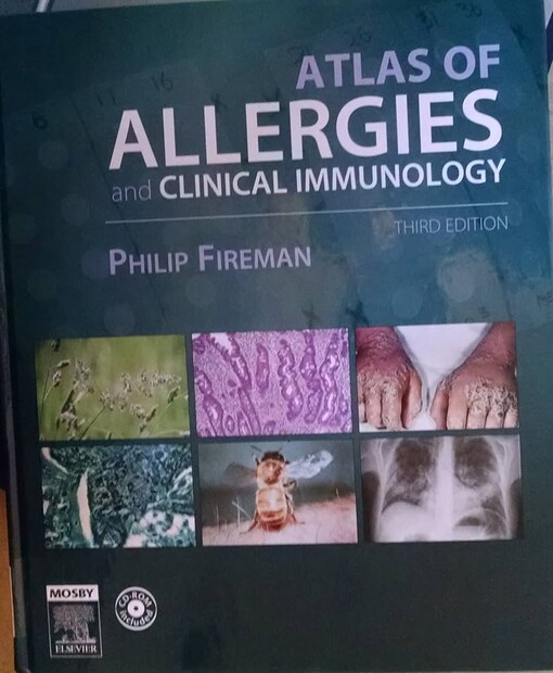 CD atlas of allergies