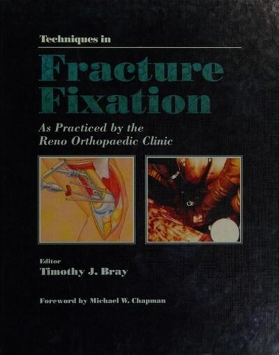 Techniques in fracture fixation :as practised by the Reno Orthopaedic Clinic Reno, Nevada