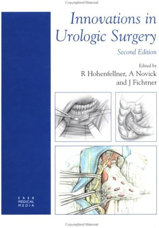 Innovations In Urologic Surgery
