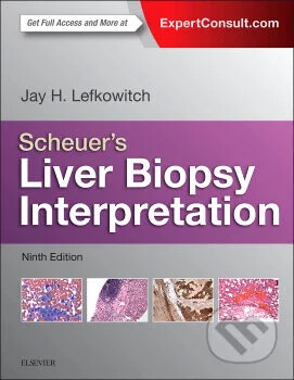 Liver biopsy interpretation