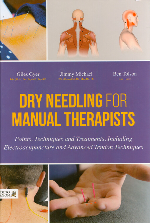 Dry needling for manual therapists : points, techniques and treatments, including electroacupuncture and advanced tendon techniques