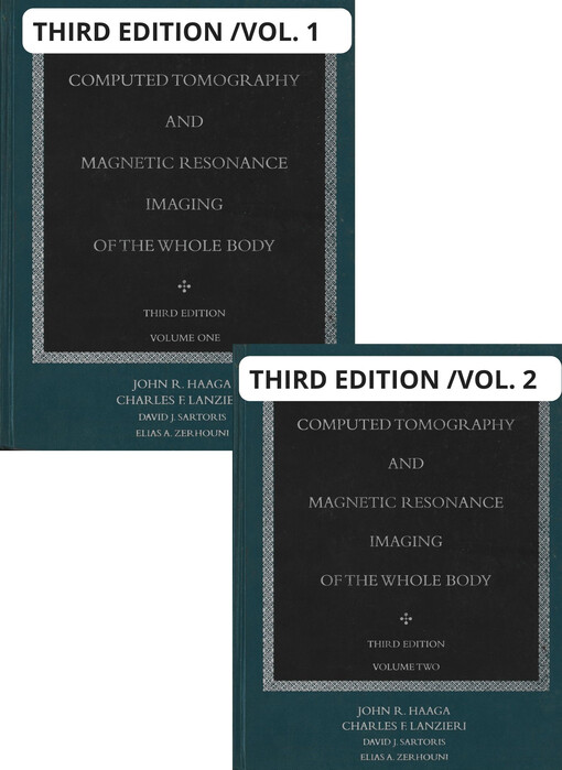 Computed tomography and magnetic resonance imaging of the whole body