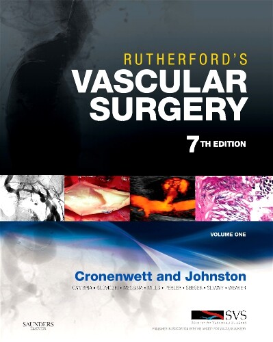 Rutherford's Vascular Surgery, 2-Volume Set: Expert Consult: Print and Online (Vascular Surgery (Rutherford)(2 Vol.))